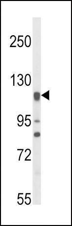 Anti-NOS3 (N-term) Antibody