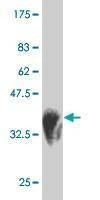 Anti-HUNK Antibody