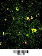 Anti-Rab5 (C-term) Antibody