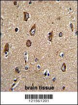 Anti-Rab5 (C-term) Antibody
