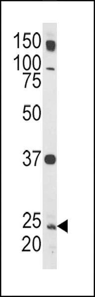 Anti-Rab5 (C-term) Antibody