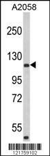 Anti-HMHA1 (Center) Antibody