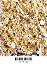 Anti-ITGAX (C-term) Antibody
