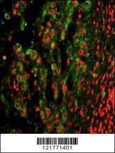 Anti-ITGAX (C-term) Antibody