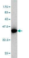 Anti-ICA1 Antibody