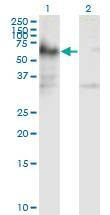 Anti-ICA1 Antibody