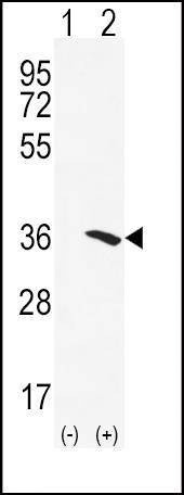 Anti-NAT2 (C-term) Antibody