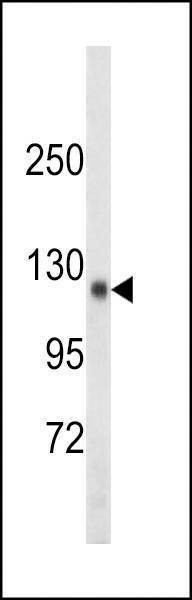 Anti-SDCCAG33 (Center) Antibody