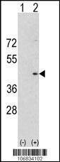 Anti-Aurora-A (C-term) Antibody