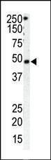 Anti-GRK1 (C-term) Antibody