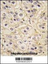 Anti-GRK1 (C-term) Antibody