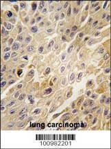 Anti-ADRBK1 (C-term) Antibody