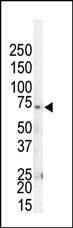 Anti-GRK4 (C-term) Antibody