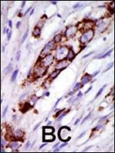 Anti-GRK5 (C-term) Antibody