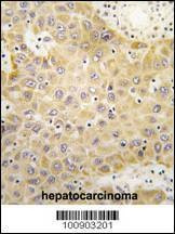 Anti-GRK5 (C-term) Antibody