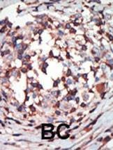 Anti-PKC beta1/2 (Center) Antibody