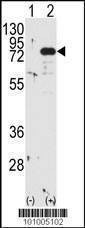 Anti-PKC beta1/2 (Center) Antibody