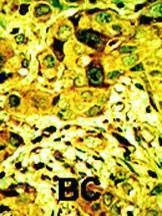 Anti-PKC delta (N-term) Antibody