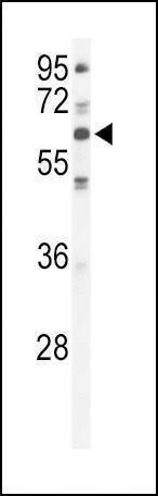 Anti-PKC iota (N-term) Antibody