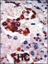 Anti-PKC iota (N-term) Antibody