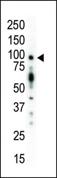 Anti-PKC mu (N-term) Antibody