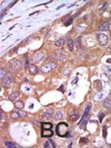 Anti-PKC mu (N-term) Antibody