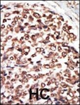 Anti-PKC nu (C-term) Antibody