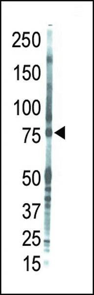 Anti-PKC theta (C-term) Antibody