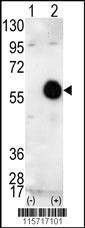 Anti-AKT2 (C-term) Antibody