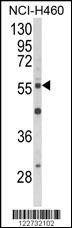Anti-AKT2 Antibody