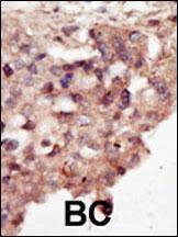 Anti-DAPK2 (N-term) Antibody