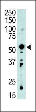 Anti-PDK2 (C-term) Antibody