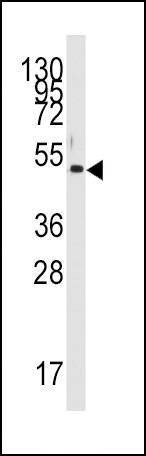 Anti-PDK4 (Center D98) Antibody