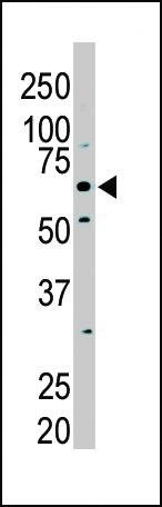 Anti-PKLR (N-term) Antibody
