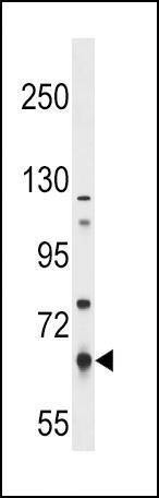 Anti-PKLR (N-term) Antibody