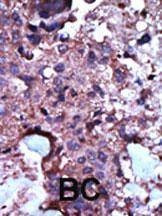 Anti-PKLR (N-term) Antibody