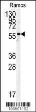 Anti-Pyruvate Kinase (PKM2) (C-term) Antibody