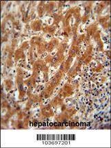 Anti-Pyruvate Kinase (PKM2) (C-term) Antibody