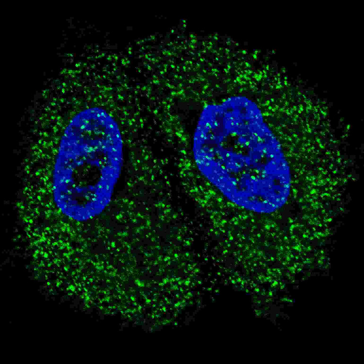 Anti-Pyruvate Kinase (PKM2) (C-term) Antibody