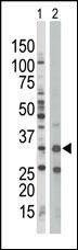 Anti-AMPK beta (PRKAB1) (N-term) Antibody