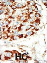 Anti-AMPK beta (PRKAB1) (N-term) Antibody