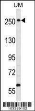 Anti-WNK3 (PRKWNK3) (C-term) Antibody