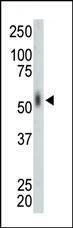 Anti-MNK2 (MKNK2) (N-term) Antibody