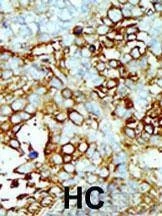 Anti-Germinal Center Kinase (GCK/MAP4K2) (Center) Antibody