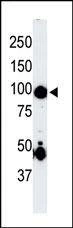 Anti-Germinal Center Kinase (GCK/MAP4K2) (Center) Antibody
