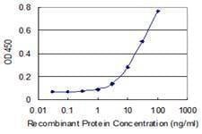 Anti-IDI2 Antibody