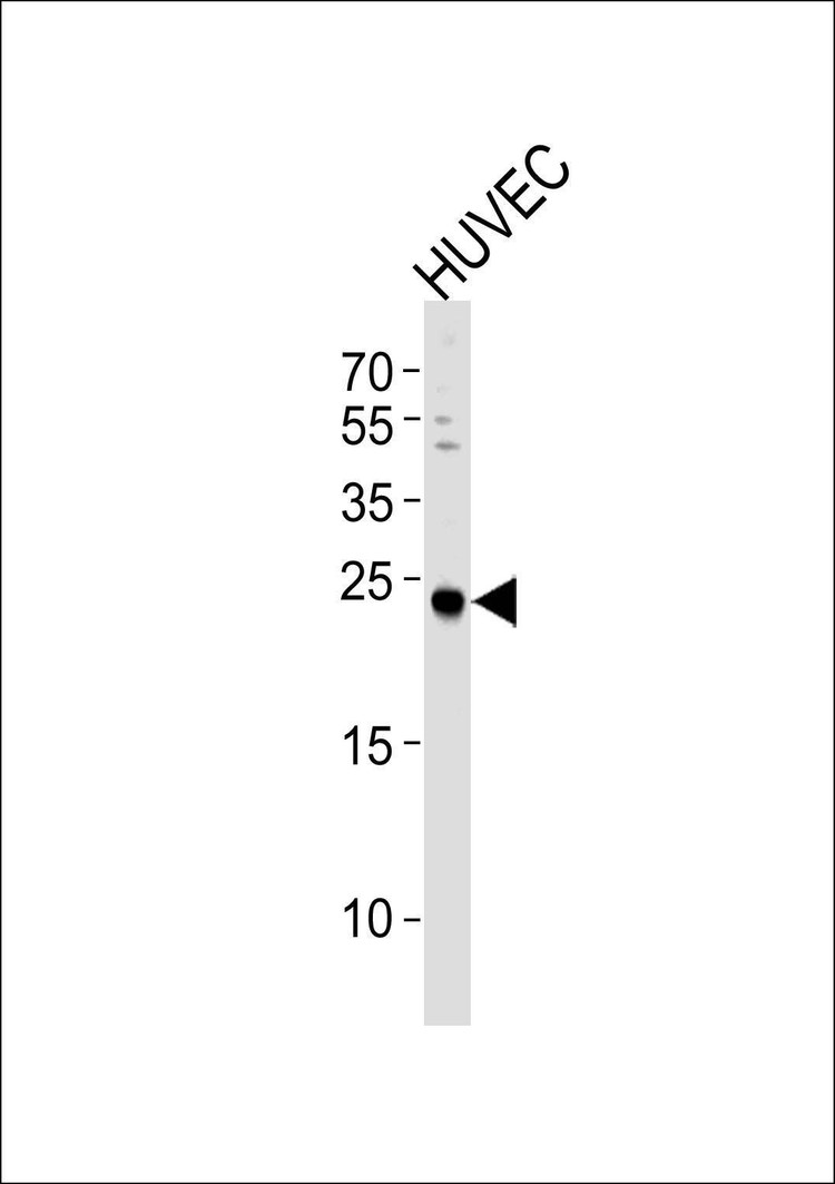 Anti-CSNK2B (C-term F168) Antibody