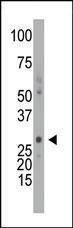 Anti-DCK (C-term) Antibody