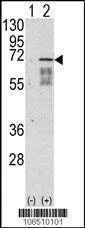 Anti-Activin Receptor Type IA (ACVR1) (Center N153) Antibody