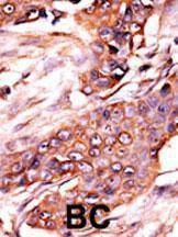 Anti-Activin Receptor Type IA (ACVR1) (N-term) Antibody